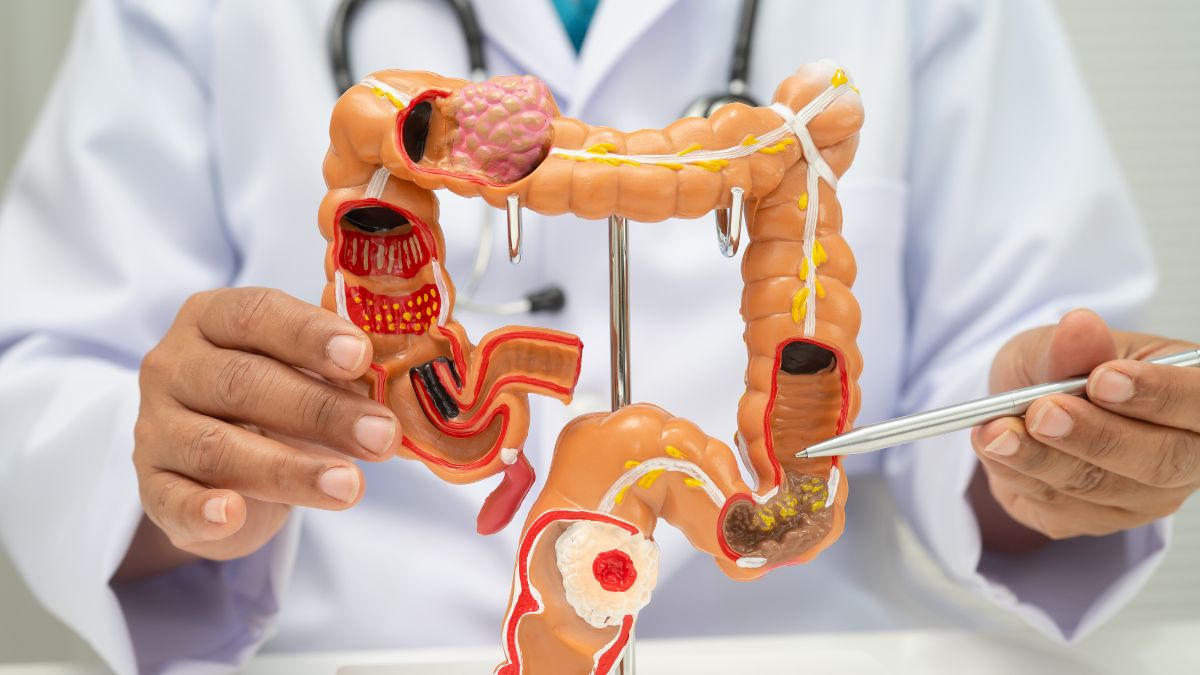 From Campus To Cancer Center: The Journey Of A Cancer Strategist